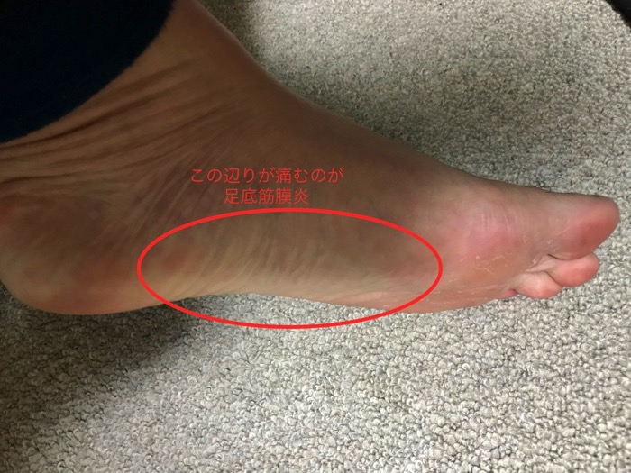 CJGLI1XuSzGsP62mHPXNAg_thumb_9d49.jpg CJGLI1XuSzGsP62mHPXNAg thumb 9d49
